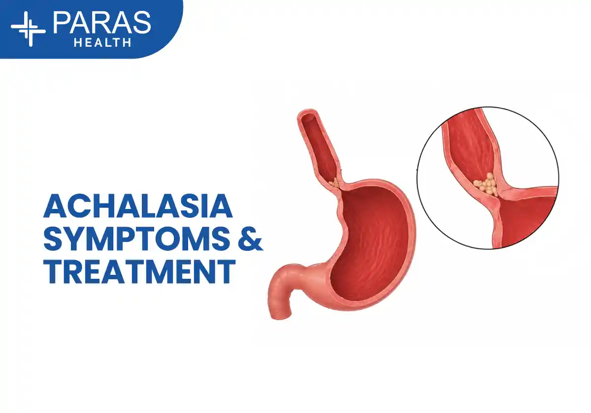Achalasia Disease